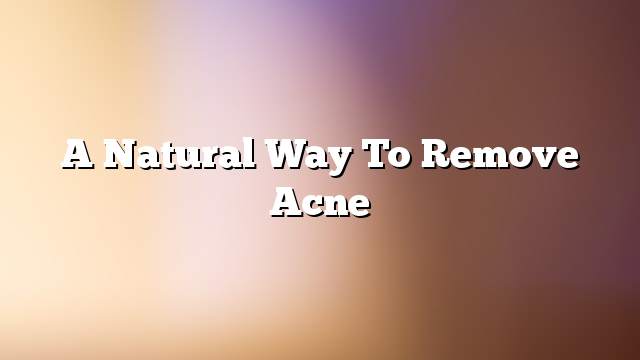 A natural way to remove acne