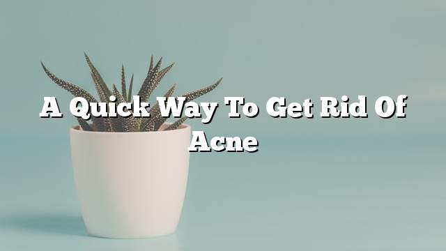 A quick way to get rid of acne