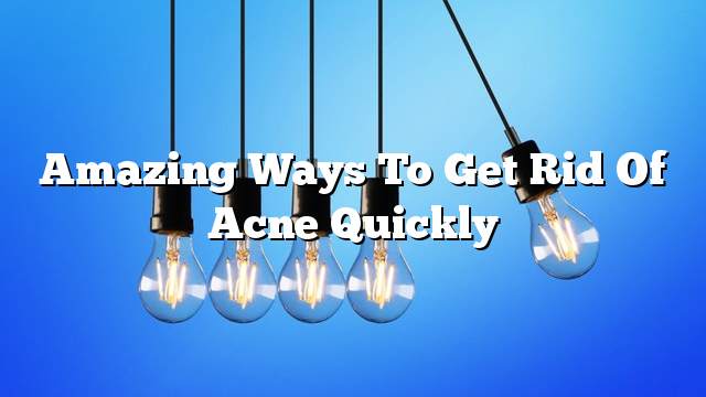 Amazing ways to get rid of acne quickly