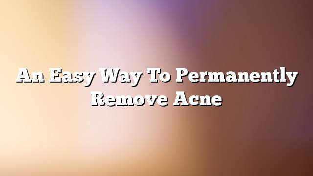 An easy way to permanently remove acne