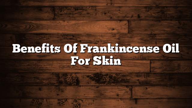 Benefits of frankincense oil for skin