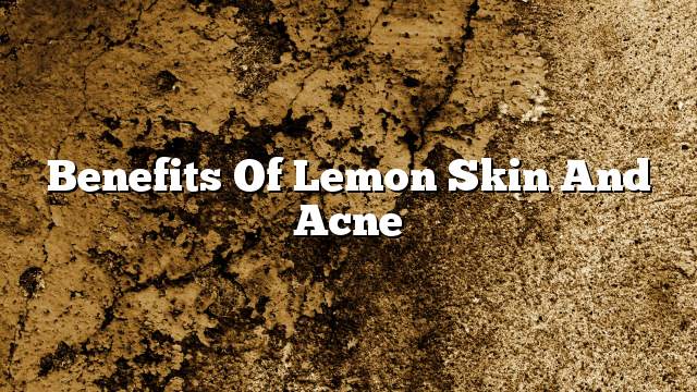 Benefits of lemon skin and acne