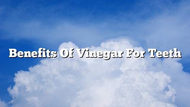 Benefits of vinegar for teeth