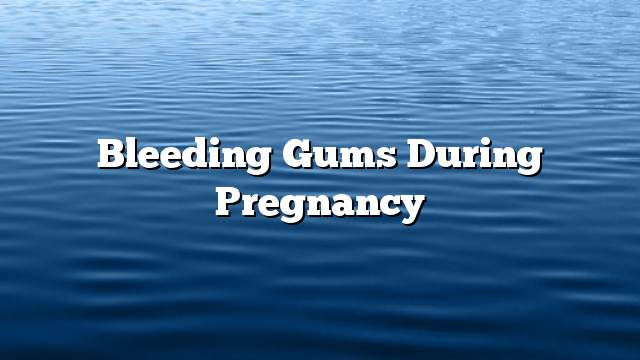 Bleeding gums during pregnancy