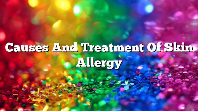 Causes and treatment of skin allergy