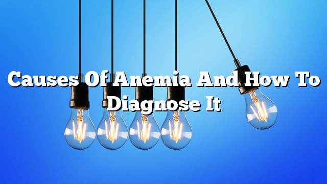 Causes of anemia and how to diagnose it