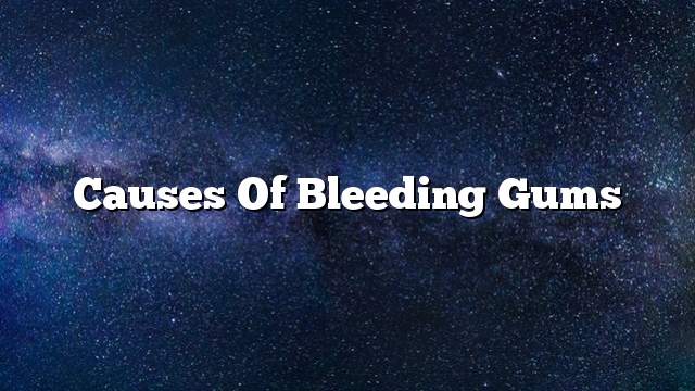 Causes of bleeding gums