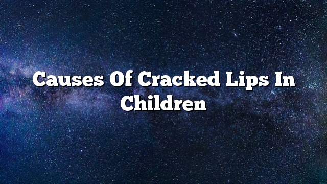 Causes of cracked lips in children