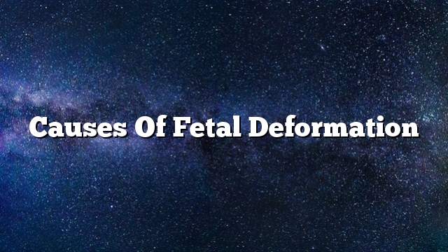 Causes of fetal deformation