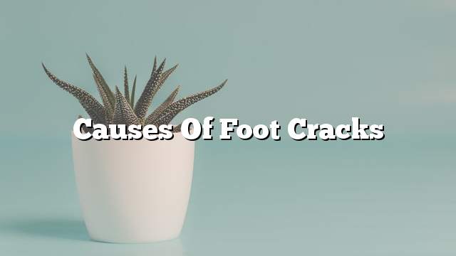 Causes of foot cracks