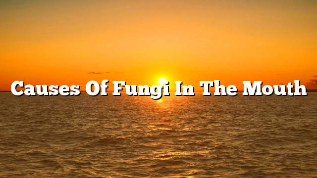Causes of fungi in the mouth