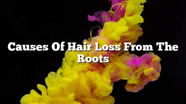 Causes of hair loss from the roots