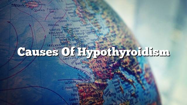 Causes of hypothyroidism