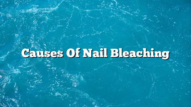 Causes of nail bleaching