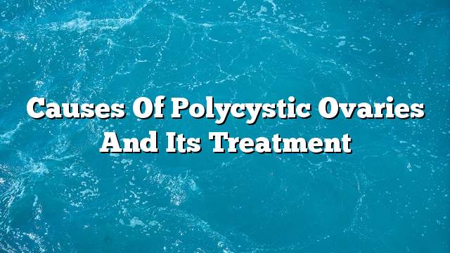 Causes of Polycystic ovaries and its treatment