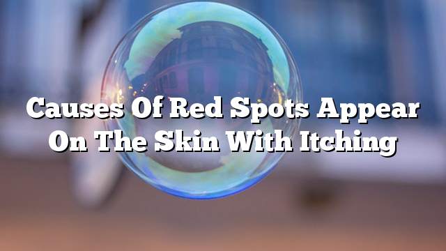 Causes of red spots appear on the skin with itching