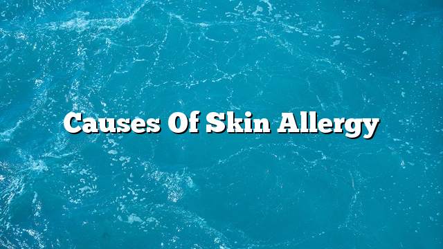 Causes of skin allergy