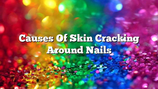 Causes of skin cracking around nails