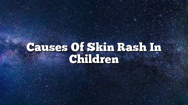 Causes of skin rash in children