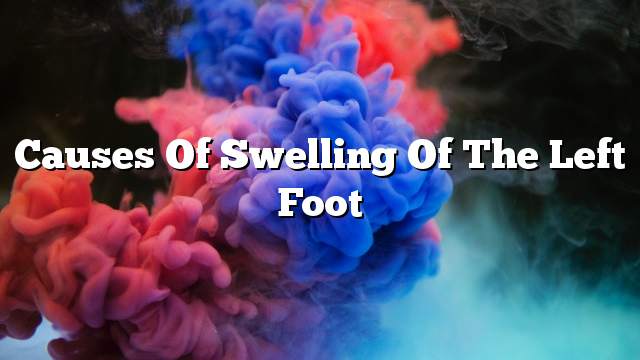 Causes of swelling of the left foot