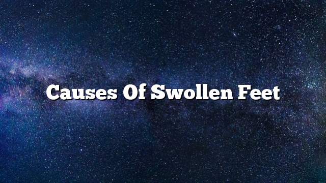 Causes of swollen feet