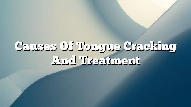 Causes of tongue cracking and treatment