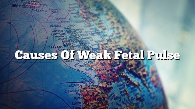 Causes of weak fetal pulse