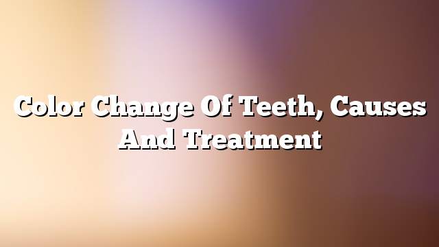 Color change of teeth, causes and treatment