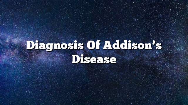 Diagnosis of Addison’s disease