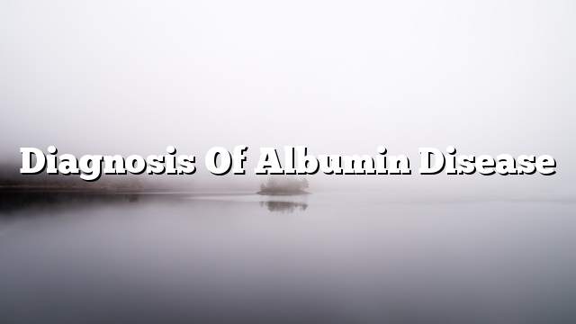 Diagnosis of albumin disease