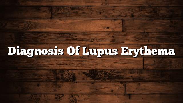 Diagnosis of lupus erythema