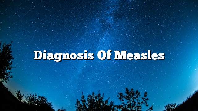 Diagnosis of measles