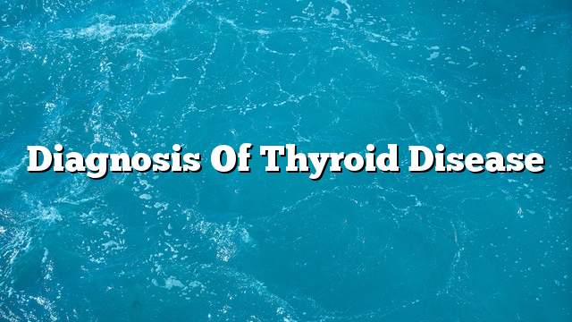 Diagnosis of thyroid disease