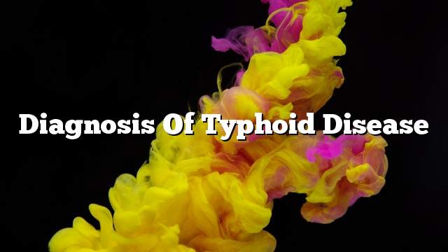 Diagnosis of typhoid disease