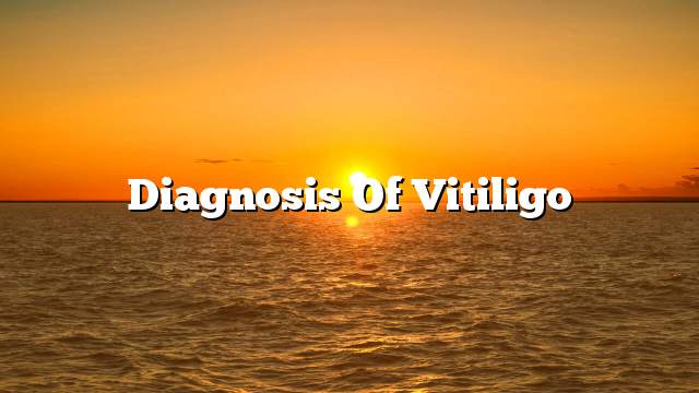 Diagnosis of vitiligo