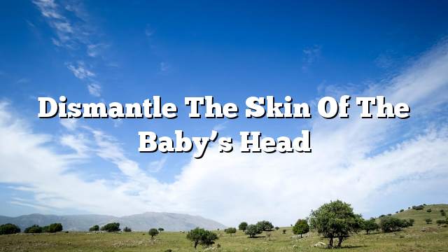 Dismantle the skin of the baby’s head