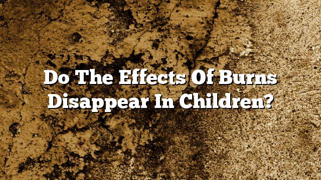 Do the effects of burns disappear in children?