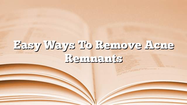 Easy ways to remove acne remnants