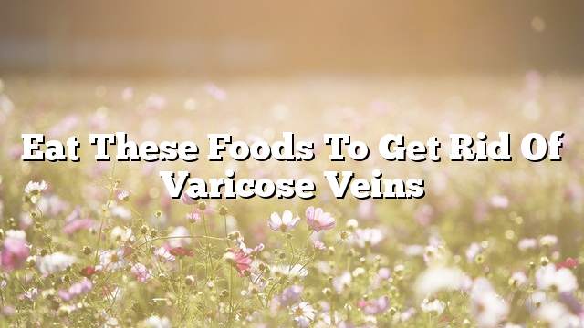 Eat these foods to get rid of varicose veins