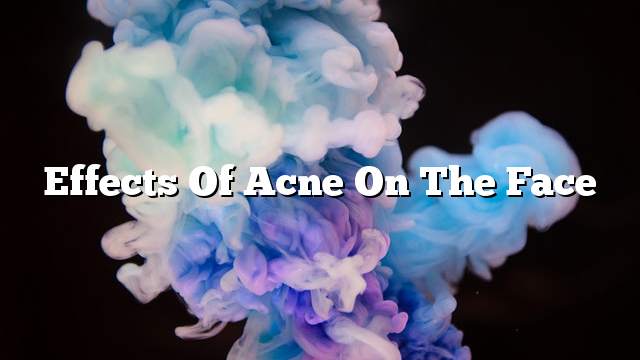 Effects of acne on the face