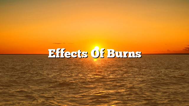 Effects of burns