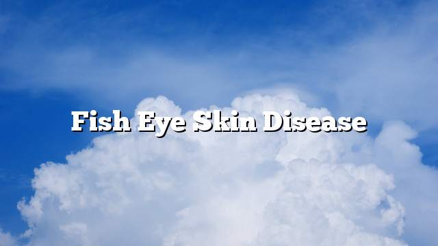 fish eye skin disease