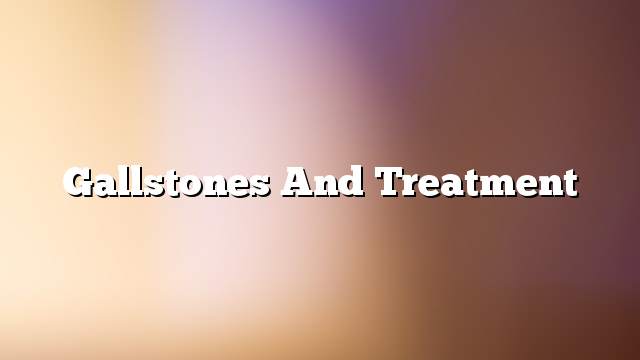 Gallstones and treatment