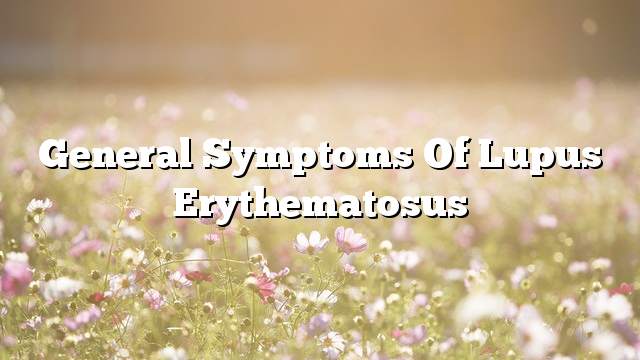 General symptoms of lupus erythematosus