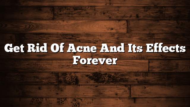 Get rid of acne and its effects forever