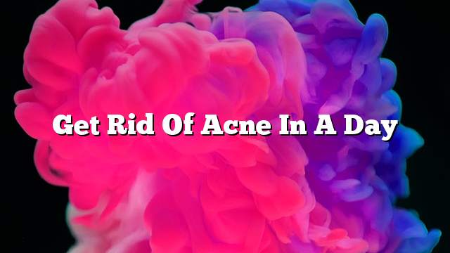 Get rid of acne in a day