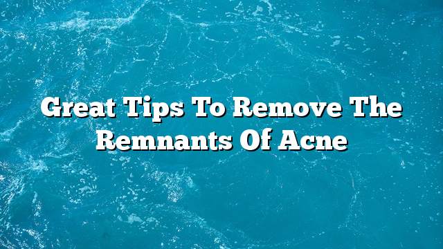 Great tips to remove the remnants of acne