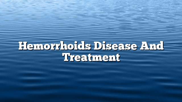 Hemorrhoids disease and treatment