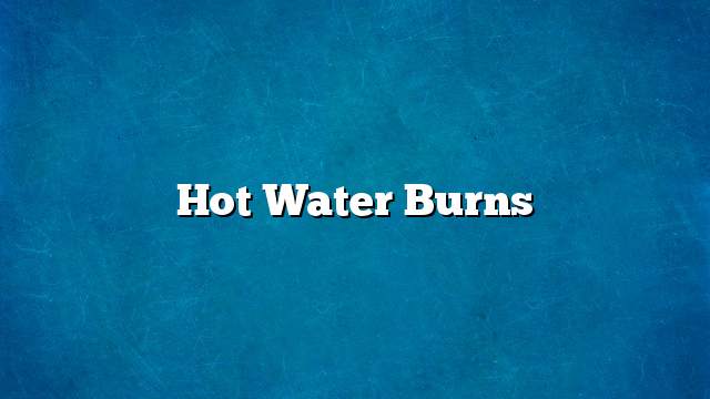 Hot water burns