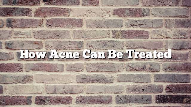 How Acne Can Be Treated